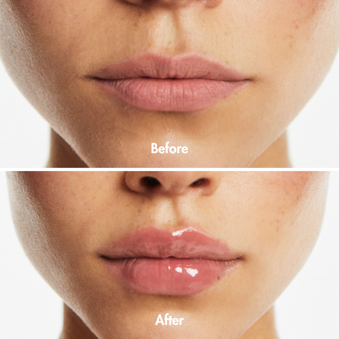 Smooche Extreme Lip Plumper Transparent Results